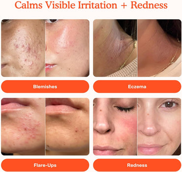 Tower 28 SOS Daily Rescue Facial Spray for Sensitive Skin, Hypochlorous Acid Spray Helps Reduce Redness and Breakouts, Travel Size Toner for Face, 1 FL Oz