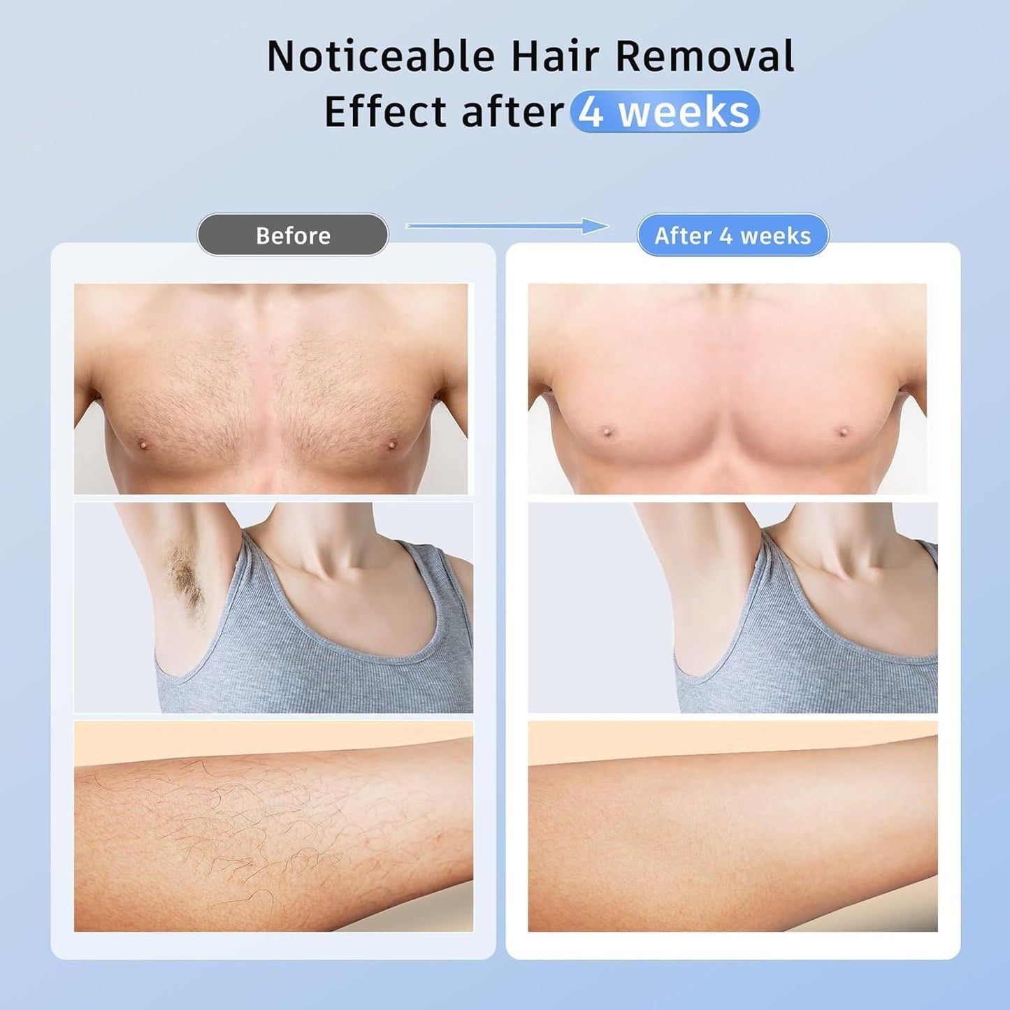 Laser Hair Removal Ubroo IPL Hair Removal Device with 5℃ Ice Cooling, 3 In 1 Painless Hair Removal For Women Men Permanent Face Body Beauty Care (Blue)