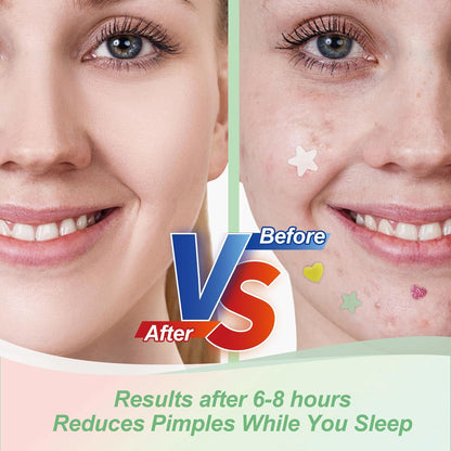 Star Pimple Patches for Face (400 Counts) Festival Beauty Party, Hydrocolloid Cute Acne Patches Cover Zits Blemishes, Zit Patches Spot Stickers Acid Tea Tree Oil,Zit Patches Pads for Skin Care